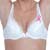Improvements in Breast Cancer Survival